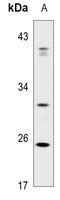 ABCC13 Antibody