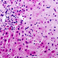PAI3 Rabbit Polyclonal Antibody