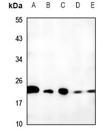 TCEAL6 Rabbit Polyclonal Antibody