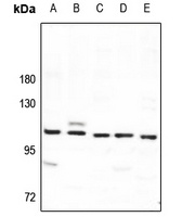 SYNE3 Rabbit Polyclonal Antibody