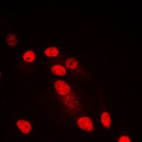 Anti-SYNE3 Antibody