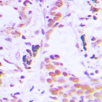Anti-TCEB3C Antibody