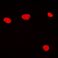 Anti-TCEB3C Antibody