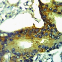 Anti-GPR125 Antibody