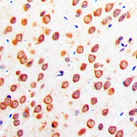 Anti-CADM4 Antibody