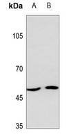 MCT13 Rabbit Polyclonal Antibody