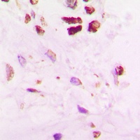 Anti-SENP5 Antibody