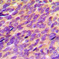 ORAOV1 Antibody