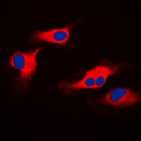 ORAOV1 Antibody