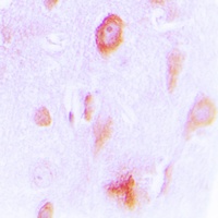 Anti-Cytochrome P450 4X1 Antibody