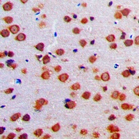 Anti-EOS Antibody