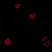 Anti-GPR110 Antibody