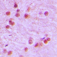 Anti-FOXR1 Antibody
