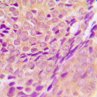 Anti-ZADH2 Antibody