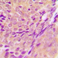 ZADH2 antibody