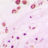 Anti-HKR1 Antibody