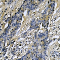 RIMKLA Antibody