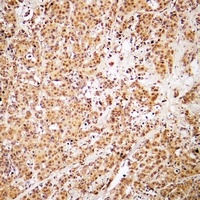 Anti-ZNF50 Antibody