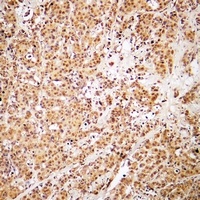 ZSCAN22 antibody