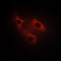 Anti-SERINC2 Antibody