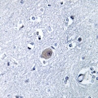 Anti-BMP8A Antibody