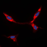 Anti-BMP8A Antibody
