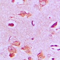Anti-MAST4 Antibody