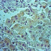 Anti-SLC6A17 Antibody