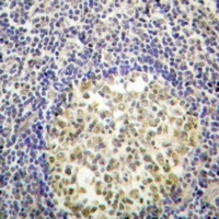 Anti-p47 phox (Phospho-S370) Antibody