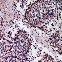 Anti-SFTPA1/2 Antibody