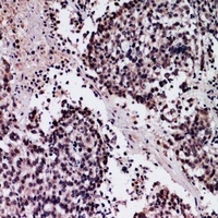 SFTPA1 antibody