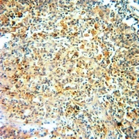 SERPINA3 antibody