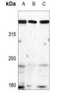 ATM Rabbit Polyclonal Antibody
