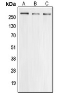 Cav2.3 Rabbit Polyclonal Antibody