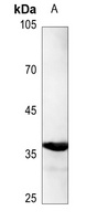 C/EBP alpha (Phospho-S193) Antibody