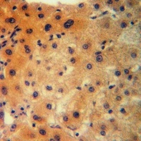 Anti-CLCN1 Antibody