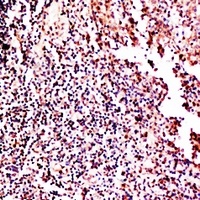 CSF2 antibody