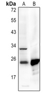p22 phox Rabbit Polyclonal Antibody