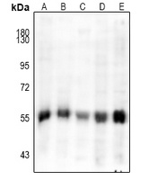 Cytochrome P450 8B1 Rabbit Polyclonal Antibody