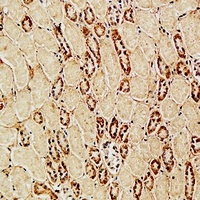 Anti-CD105 Antibody