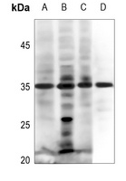 EPO Rabbit Polyclonal Antibody