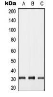 Connexin 31.1 Rabbit Polyclonal Antibody