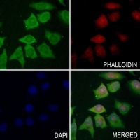 Beta-galactosidase Antibody