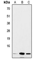 Insulin Antibody