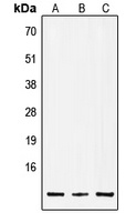 Insulin Rabbit Polyclonal Antibody
