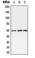 Monoamine Oxidase A Rabbit Polyclonal Antibody
