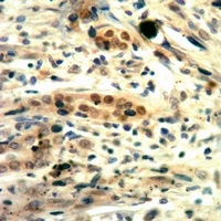 c-Met (Phospho-Y1235) Antibody
