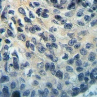 Anti-MYBPC2 Antibody