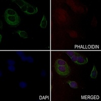 Anti-MYBPC2 Antibody