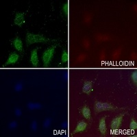 Anti-GADD45 beta Antibody
